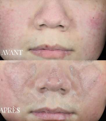 Masque soin détoxifiant 20 g