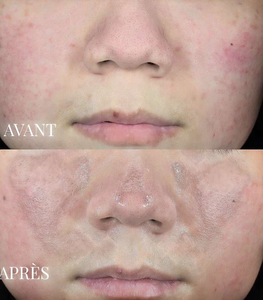 Masque soin détoxifiant 20 g
