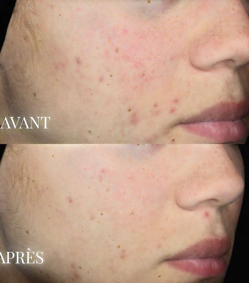Masque soin détoxifiant 20 g