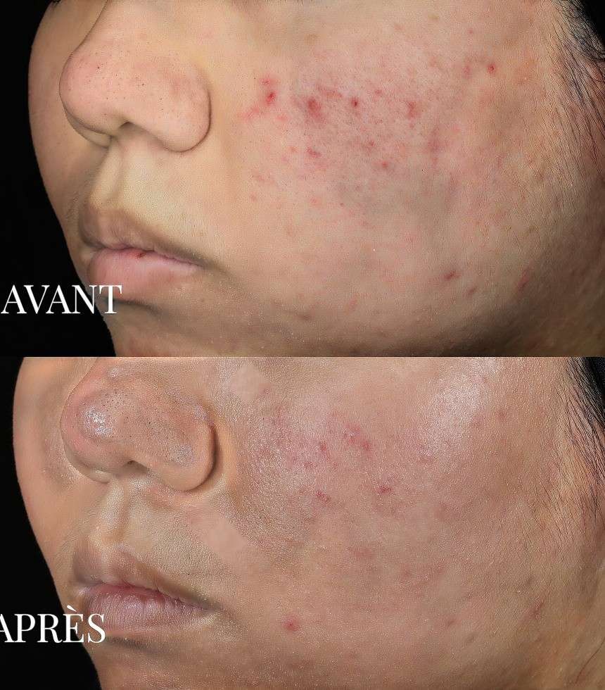 Masque soin détoxifiant 20 g